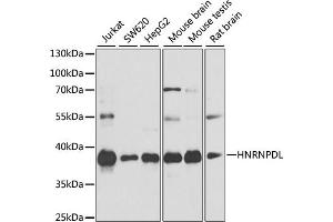 Western blot analysis of extracts of various cell lines, using HNRNPDL antibody (ABIN6127960, ABIN6141907, ABIN6141908 and ABIN6214947) at 1:1000 dilution. (HNRPDL Antikörper  (AA 261-420))