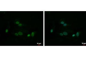 ICC/IF Image HMGB1 antibody detects HMGB1 protein at nucleus by immunofluorescent analysis. (HMGB1 Antikörper)