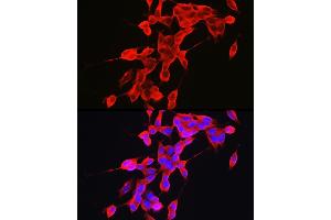 Immunofluorescence analysis of SH-SY5Y cells using α-Synuclein Rabbit pAb (ABIN6129177, ABIN6148190, ABIN6148192 and ABIN6223046) at dilution of 1:100 (40x lens). (SNCA Antikörper  (AA 61-140))