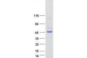Western Blotting (WB) image for Guanine Nucleotide Binding Protein (G Protein), alpha Inhibiting Activity Polypeptide 1 (GNAI1) protein (Myc-DYKDDDDK Tag) (ABIN2721496)