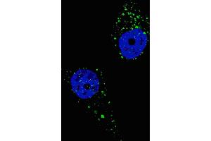 Fluorescent image of  cells stained with UVRAG (C-term) antibody. (UVRAG Antikörper  (C-Term))