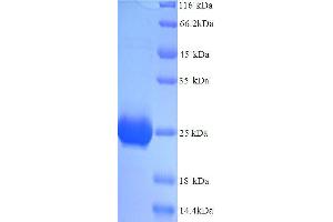 Prolactin (PRL) (AA 31-229), (full length) protein (His tag) (Prolactin Protein (PRL) (AA 31-229, full length) (His tag))