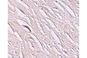 Immunohistochemical staining of human brain cells with SLC39A2 polyclonal antibody  at 2.