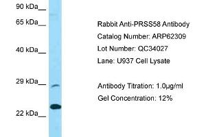 Western Blotting (WB) image for anti-Protease, serine, 58 (PRSS58) (C-Term) antibody (ABIN2789104)