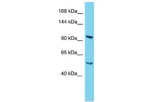 Host:  Rabbit  Target Name:  Radil  Sample Type:  Mouse Lung lysates  Antibody Dilution:  1.