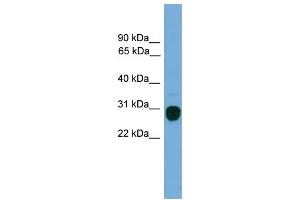 WB Suggested Anti-TREM2 Antibody Titration:  0.