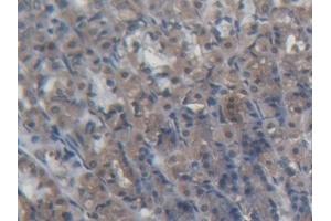 Detection of PDP2 in Rat Stomach Tissue using Polyclonal Antibody to Pyruvate Dehydrogenase Phosphatase 2 (PDP2) (PDP2 Antikörper  (AA 1-187))