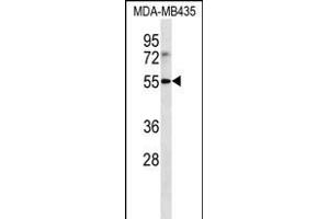 LILRB4 Antibody (N-term) (ABIN656231 and ABIN2845546) western blot analysis in MDA-M cell line lysates (35 μg/lane). (LILRB4 Antikörper  (N-Term))