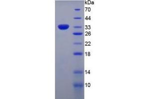 SDS-PAGE analysis of Human Collagen Type VII Protein.