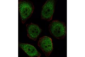 Fluorescent image of  cell stained with P1CB Antibody (C-term) (ABIN392847 and ABIN2842269). (PPP1CB Antikörper  (C-Term))