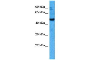 Western Blotting (WB) image for anti-Activin A Receptor, Type IIB (ACVR2B) (Middle Region) antibody (ABIN2782111)