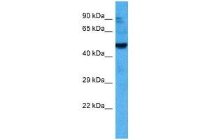 Host:  Mouse  Target Name:  ACVR2B  Sample Tissue:  Mouse Testis  Antibody Dilution:  1ug/ml (ACVR2B Antikörper  (Middle Region))