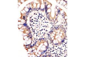 Immunohistochemical analysis of paraffin-embedded H. (CARD6 Antikörper)