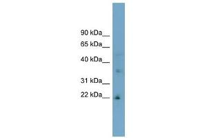 LDLRAD1 antibody used at 1 ug/ml to detect target protein. (LDLRAD1 Antikörper  (Middle Region))