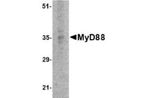 Western Blotting (WB) image for anti-Myeloid Differentiation Primary Response Gene (88) (MYD88) (AA 176-280) antibody (ABIN492527) (MYD88 Antikörper  (AA 176-280))