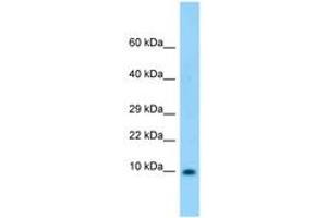 Image no. 1 for anti-S100 Calcium Binding Protein B (S100B) (AA 27-76) antibody (ABIN6748322) (S100B Antikörper  (AA 27-76))