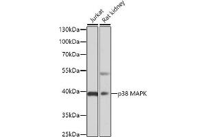 Western blot analysis of extracts of various cell lines, using p38 MAPK antibody (ABIN6130006, ABIN6143525, ABIN6143527 and ABIN6221180) at 1:3000 dilution.