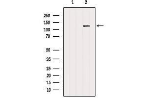 Western blot analysis of extracts from B16F10, using NFAT4 Antibody. (NFATC3 Antikörper  (N-Term))