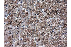 Immunohistochemical staining of paraffin-embedded Human liver tissue using anti-ADH1B mouse monoclonal antibody. (ADH1B Antikörper)