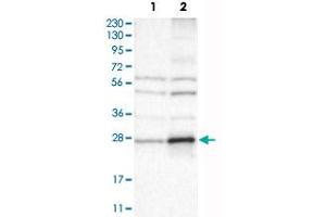 Western Blot analysis of Lane 1: RT-4 and Lane 2: U-251 MG sp cell lysates with CYBRD1 polyclonal antibody . (Cytochrome B Reductase 1 Antikörper)