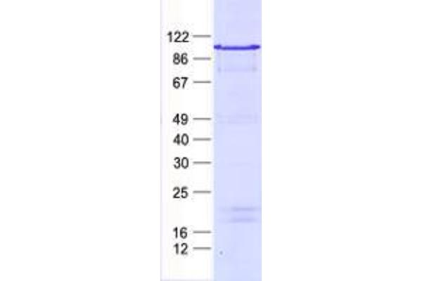 ZNF202 Protein (His tag)