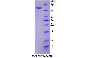 SDS-PAGE (SDS) image for Angiotensinogen (serpin Peptidase Inhibitor, Clade A, Member 8) (AGT) protein (ABIN3008304)