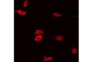 ABIN6272395 staining Hela by IF/ICC. (PXMP4 Antikörper  (N-Term))