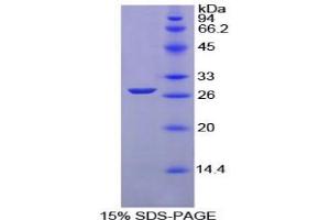 SDS-PAGE analysis of Chicken GSTm1 Protein. (GSTM1 Protein)