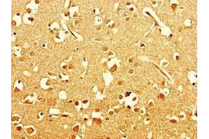 Immunohistochemistry of paraffin-embedded human brain tissue using ABIN7151354 at dilution of 1:100 (ART5 Antikörper  (AA 45-291))