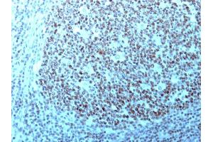 Formalin-fixed, paraffin-embedded human Tonsil stained with Nucleolin Monoclonal Antibody (364-5 + NCL/902). (Nucleolin Antikörper)