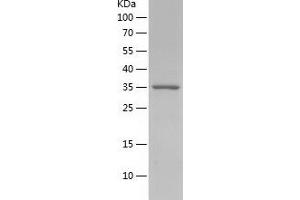 Western Blotting (WB) image for CD9 (CD9) (AA 110-192) protein (His-IF2DI Tag) (ABIN7122218) (CD9 Protein (CD9) (AA 110-192) (His-IF2DI Tag))