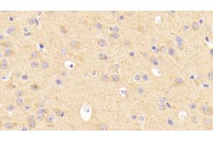 Detection of LDLR in Mouse Cerebrum Tissue using Polyclonal Antibody to Low Density Lipoprotein Receptor (LDLR) (LDLR Antikörper  (AA 263-509))