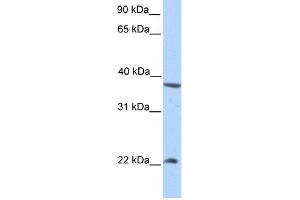 NEK7 antibody used at 1 ug/ml to detect target protein. (NEK7 Antikörper)