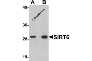 Western Blotting (WB) image for anti-Sirtuin 6 (SIRT6) (C-Term) antibody (ABIN1030666) (SIRT6 Antikörper  (C-Term))