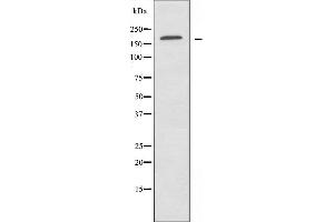 Western blot analysis of extracts from HUVEC cells, using ABCA8 antibody. (ABCA8 Antikörper  (Internal Region))