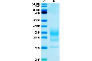 Biotinylated Mouse IL-5 on Tris-Bis PAGE under reduced condition. (IL-5 Protein (AA 21-133) (His-Avi Tag,Biotin))