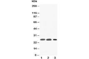 Western blot testing of SFTPA1 antibody and Lane 1:  rat lung;  2: rat lung;  3: human Raji