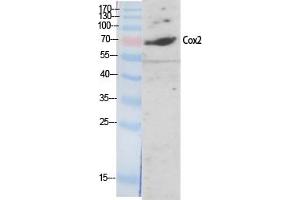 Western Blotting (WB) image for anti-Cytochrome C Oxidase Subunit II (COX2) antibody (ABIN5959232) (COX2 Antikörper)