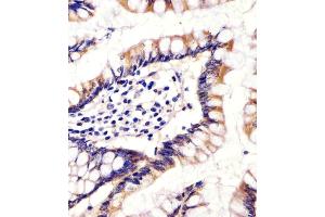 (ABIN655163 and ABIN2844780) staining CYP11B2 in human small intestine tissue sections by Immunohistochemistry (IHC-P - paraformaldehyde-fixed, paraffin-embedded sections). (CYP11B2 Antikörper  (AA 120-147))