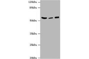 Western blot All lanes: HARS antibody at 6 μg/mL Lane 1: Hela whole cell lysate Lane 2: K562 whole cell lysate Lane 3: 293T whole cell lysate Secondary Goat polyclonal to rabbit IgG at 1/10000 dilution Predicted band size: 58, 53, 51, 55 kDa Observed band size: 58 kDa (HARS1/Jo-1 Antikörper  (AA 1-180))