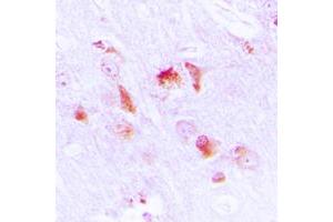 Immunohistochemical analysis of Apolipoprotein L2 staining in human brain formalin fixed paraffin embedded tissue section.