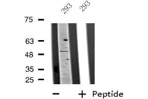 Western blot analysis of extracts from 293 cells, using PLAGL1 antibody.