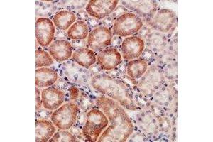Immunohistochemical analysis of CD168 staining in human kidney formalin fixed paraffin embedded tissue section. (HMMR Antikörper)