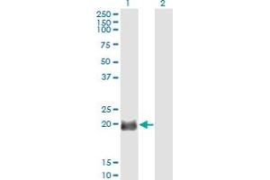 Western Blot analysis of EXOSC1 expression in transfected 293T cell line by EXOSC1 monoclonal antibody (M01), clone 2E9. (EXOSC1 Antikörper  (AA 1-195))