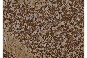 ABIN6261257 and ABIN6277502 at 1/100 staining Rat brain tissue by IHC-P. (DDX5 Antikörper  (C-Term))