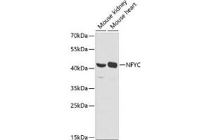 Western blot analysis of extracts of various cell lines, using NFYC antibody (ABIN6129066, ABIN6144604, ABIN6144605 and ABIN6225149) at 1:1000 dilution. (NFYC Antikörper  (AA 86-335))