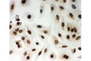 ICC testing of Lamin A antibody and A549 cells (Lamin A/C Antikörper  (AA 481-646))