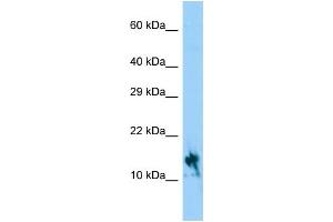Host: Rabbit Target Name: IGFL1 Sample Type: Hela Whole Cell lysates Antibody Dilution: 1. (IGFL1 Antikörper  (C-Term))