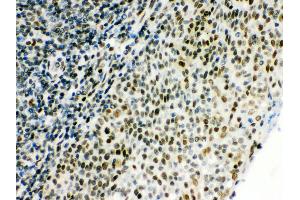Anti- CTBP1 Picoband antibody, IHC(P) IHC(P): Human Tonsil Tissue (CTBP1 Antikörper  (C-Term))