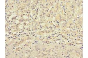 Immunohistochemistry of paraffin-embedded human adrenal gland tissue using ABIN7176327 at dilution of 1:100 (ZNF462 Antikörper  (AA 2223-2506))